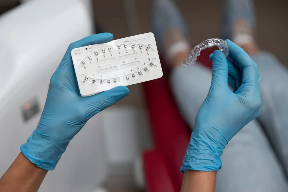 Елайнери Invisalign чи керамічні брекети: що обрати на Позняках?